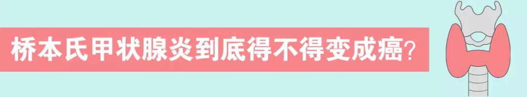 抑郁症就是心情不好？华西专家说，错，有人经常笑嘻了也可能是抑郁症！